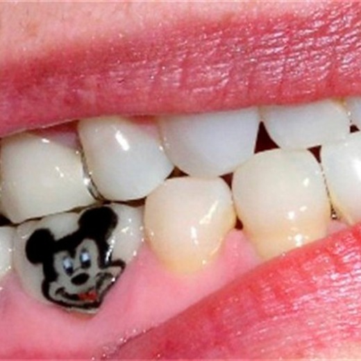 La última moda: los tatuajes en los dientes