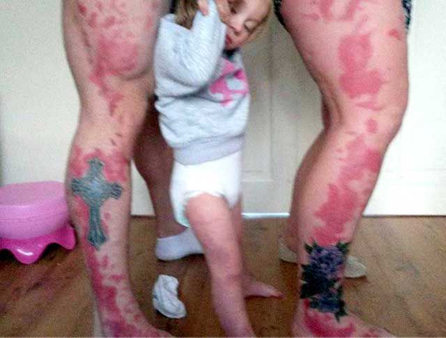 ¡Se tatúan lunares de su hija! ¡Se tatúan lunares de su hija!