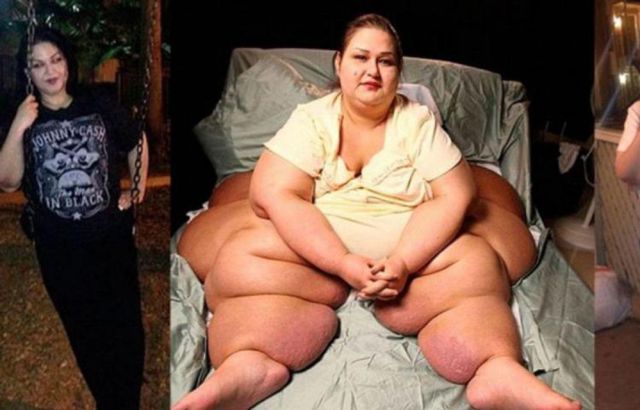 Mujer logró bajar más 358 kg Mujer logró bajar más 358 kg