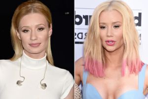 Iggy Azalea aparece con nuevo rostro en los Billboard Iggy Azalea aparece con nuevo rostro en los Billboard