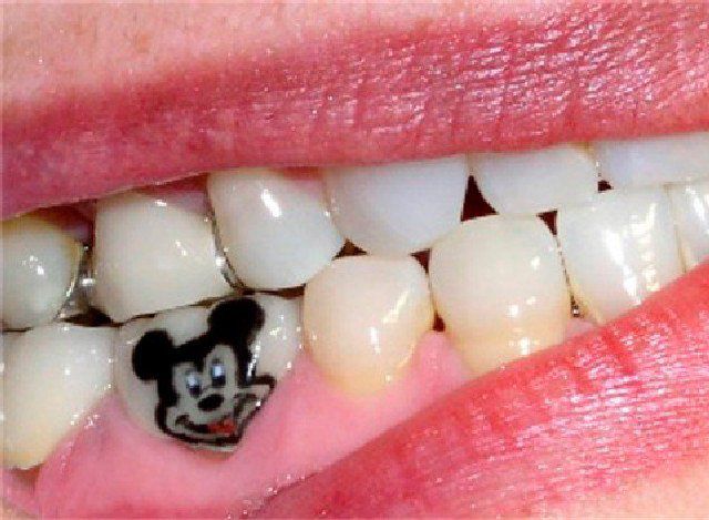 Ahora ya puedes tatuarte los dientes Ahora ya puedes tatuarte los dientes