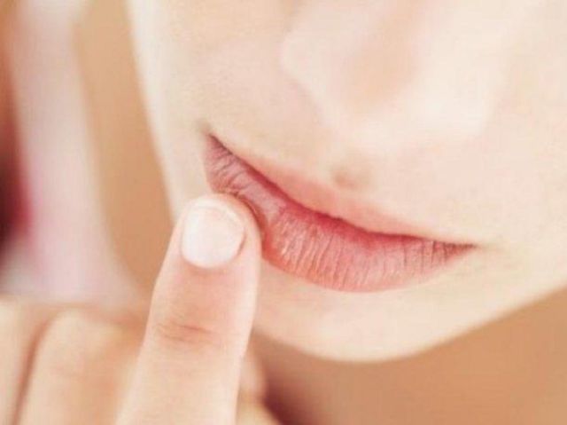 ¿Labios resecos? ¿Labios resecos?
