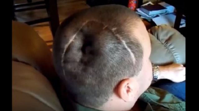 Él puede inflar y desinflar su cabeza Él puede inflar y desinflar su cabeza