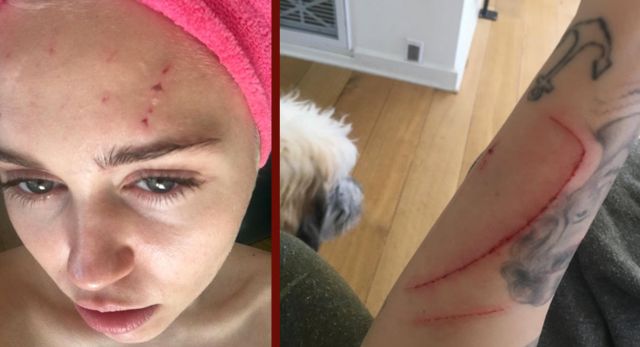 Miley Cyrus fue atacada por un gato Miley Cyrus fue atacada por un gato