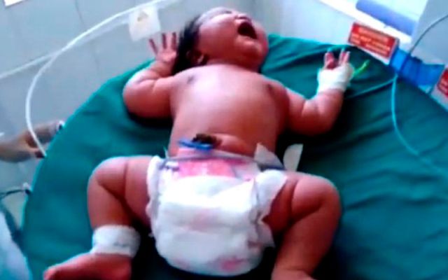 Nuevo récord de la bebé más grande del mundo