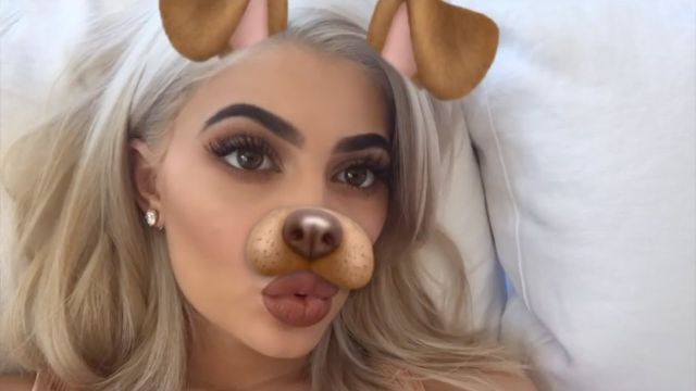 Cirujano revela todas las operaciones de Kylie Jenner