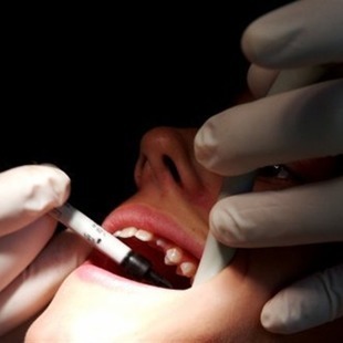Un chico de 12 años fingió secuestro para no ir al dentista