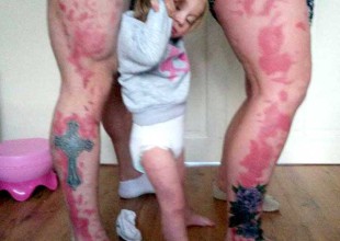 ¡Se tatúan lunares de su hija!