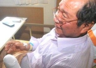 Un trabajador chino se amputa la mano para cobrar el seguro y le meten en prisión