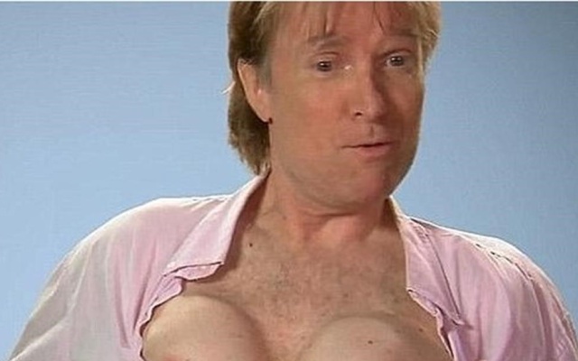 Hombre se pone implantes mamarios por una apuesta