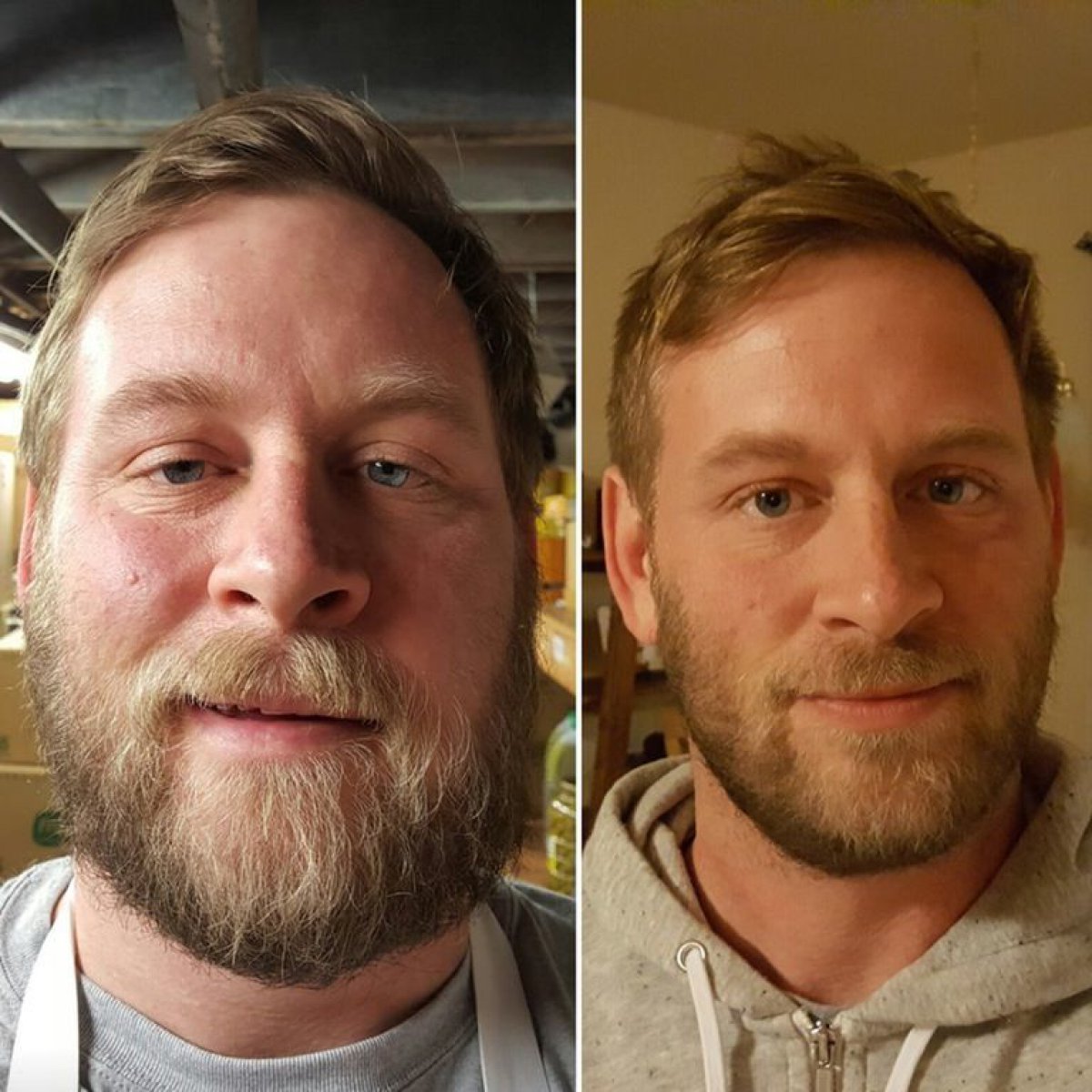 El antes y después de las personas que dejaron el alcohol