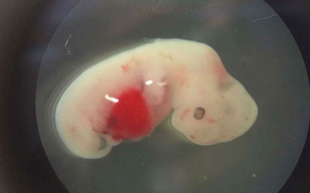 ¿Fusión de embriones de cerdos en humanos?