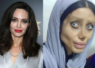 Se hizo 50 cirugías para parecerse a Angelina Jolie, el resultado, catastrófico
