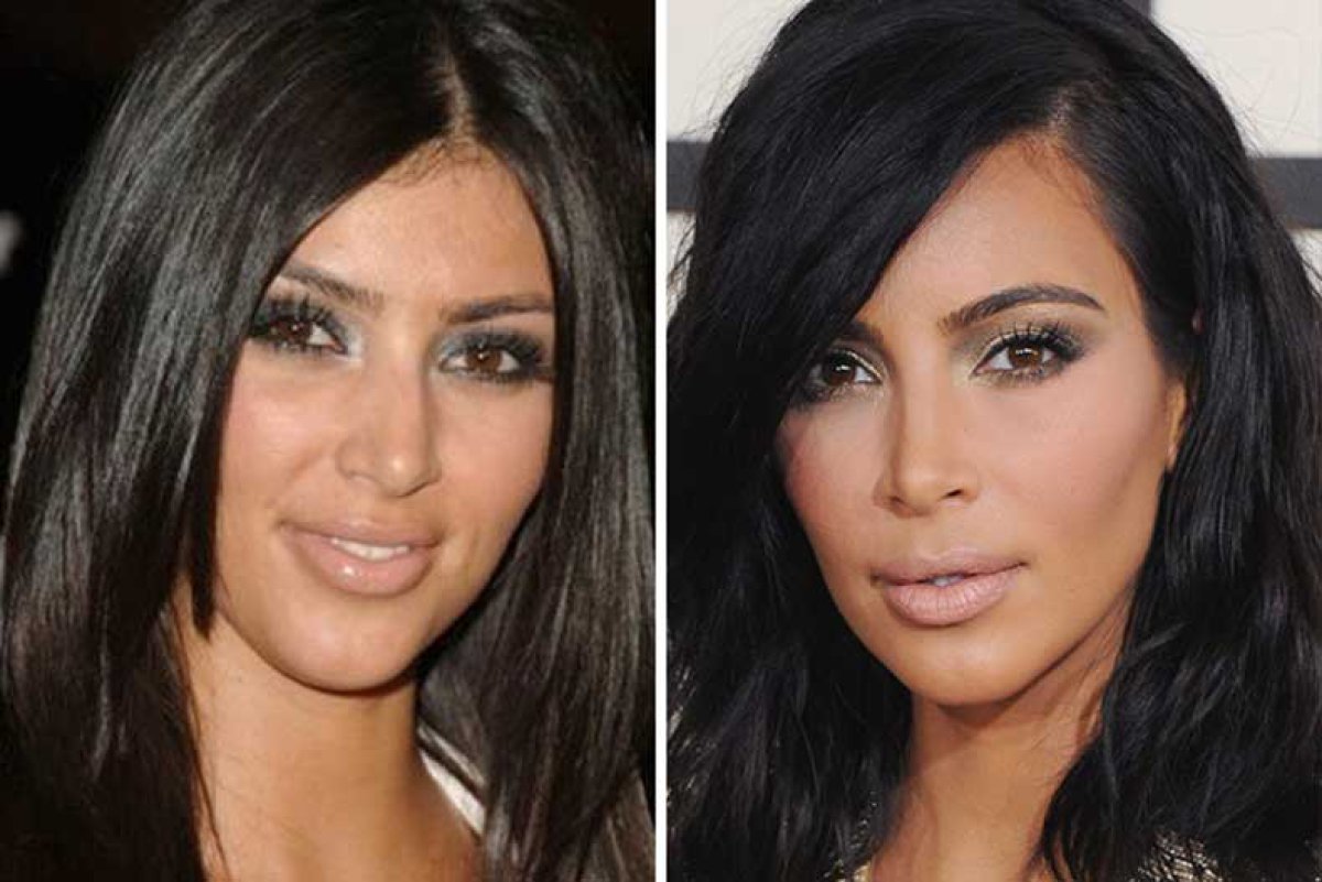 Famosas antes y después de sus cirugías en solo 15 fotografías