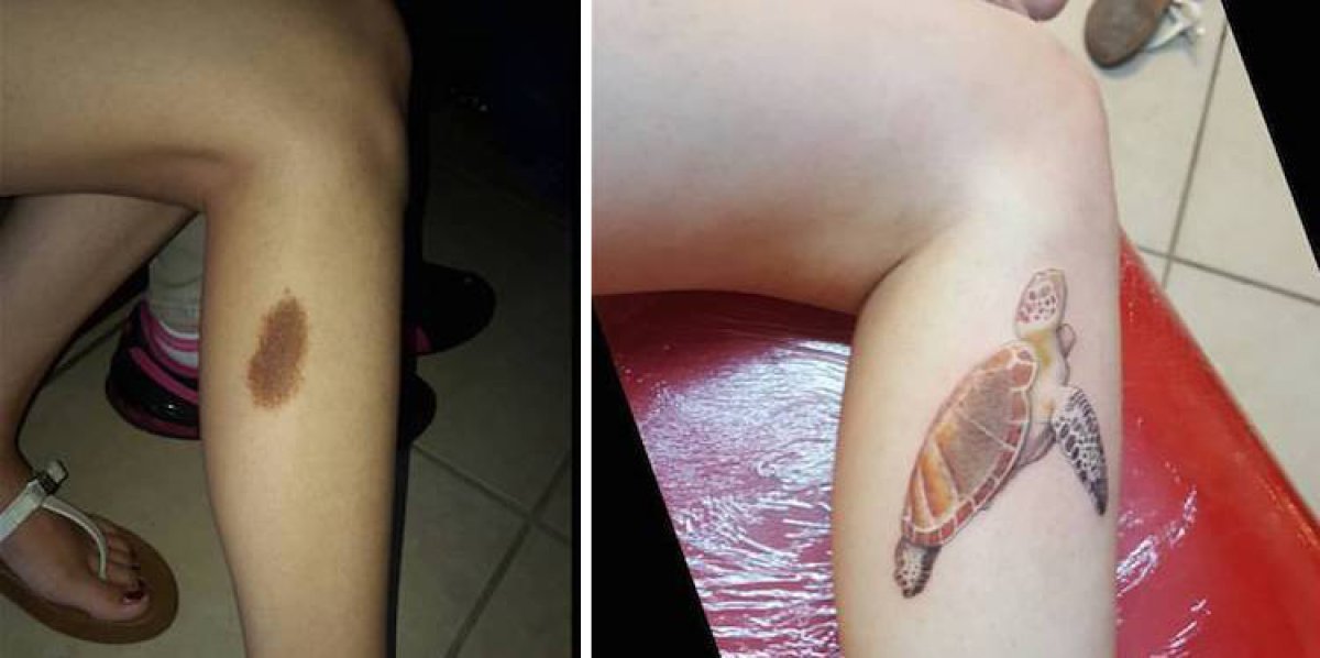 Personas que cubrieron sus cicatrices y marcas de nacimiento con divertidos tatuajes