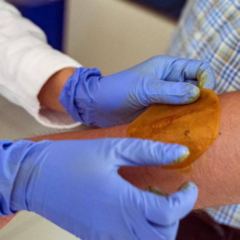 Investigadores de la UNAM crean parche para las personas diabéticas