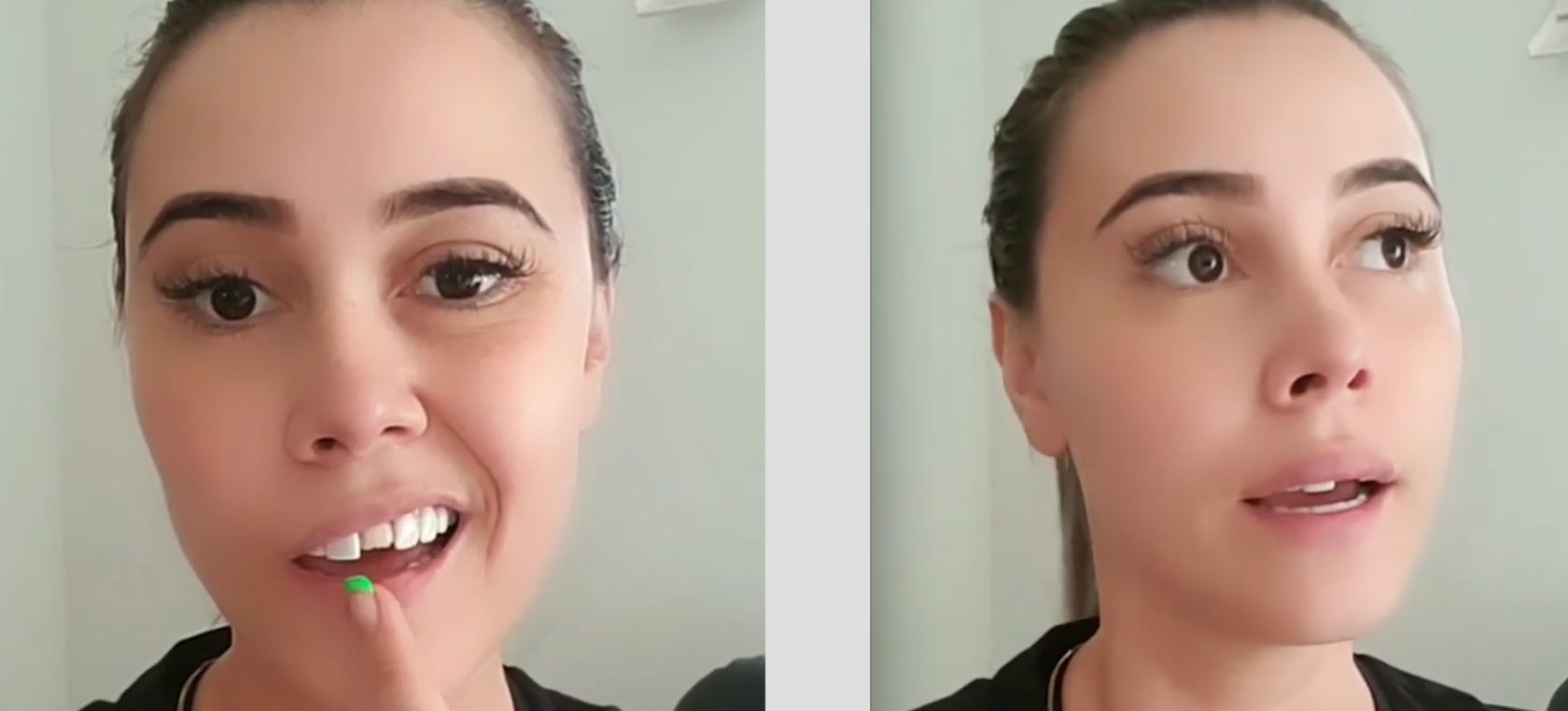 Influencer Pierde Sus Dientes Por Un Mal Diseño De Sonrisa Actualidad