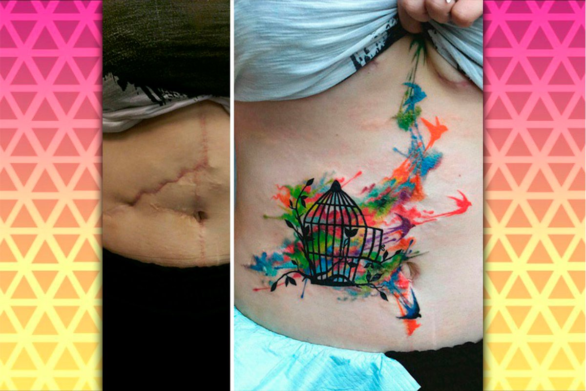 Cicatrices que se convirtieron en hermosos tatuajes | Fotogalería ...
