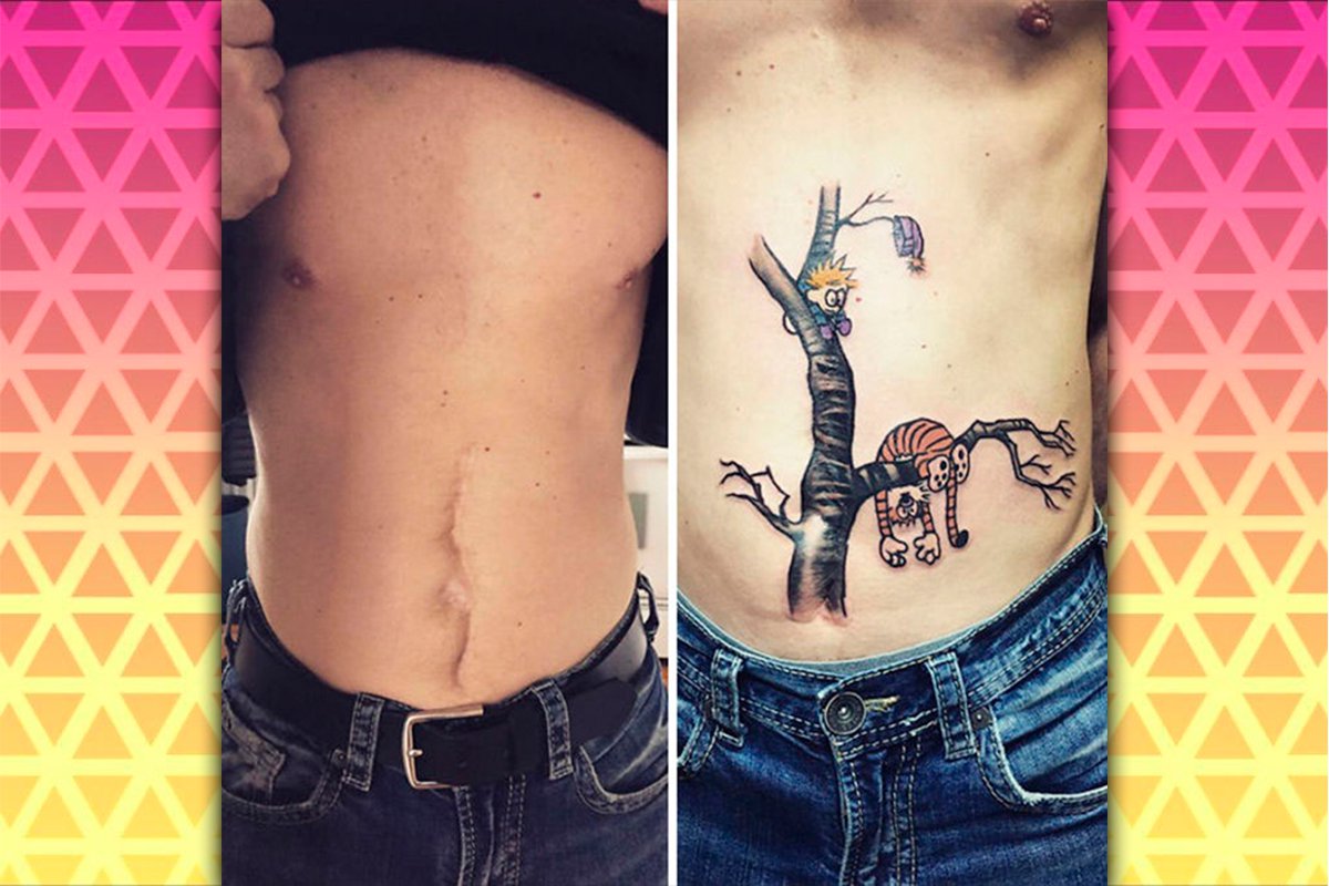 Cicatrices que se convirtieron en hermosos tatuajes | Fotogalería ...