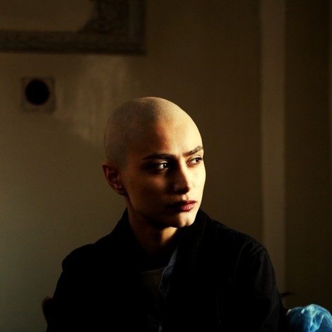 Descubren tratamiento que evitaría caída de cabello a personas con cáncer