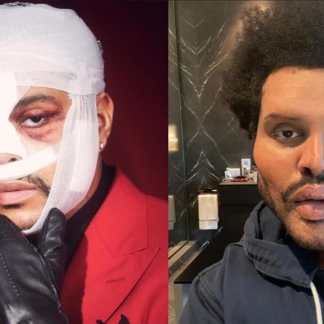 Éste es el motivo de la nueva apariencia de The Weeknd