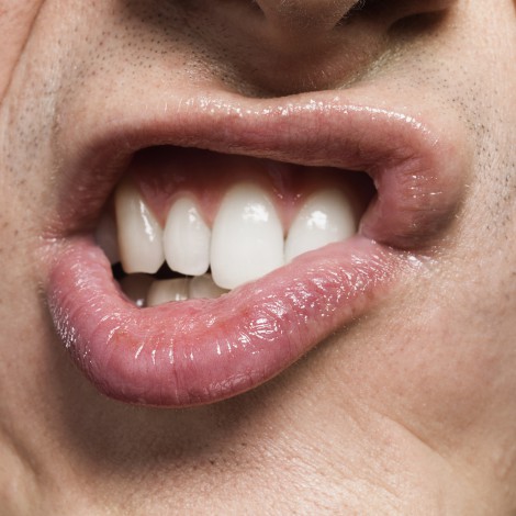 Bruxismo, una enfermedad que libera el estrés y al mismo tiempo arruina tus dientes
