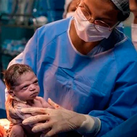 Bebé que nació enojada se reencuentra con fotógrafo que la hizo viral y recrean foto